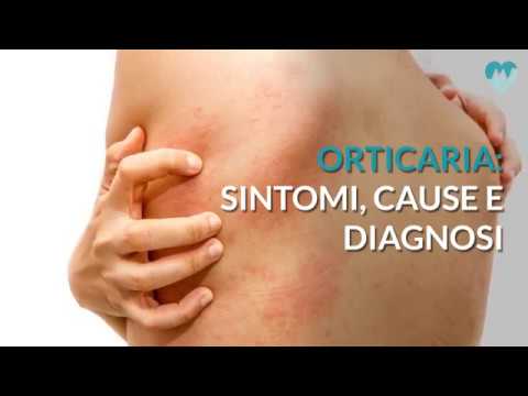 Eruzioni cutanee improvvise: cause e rimedi