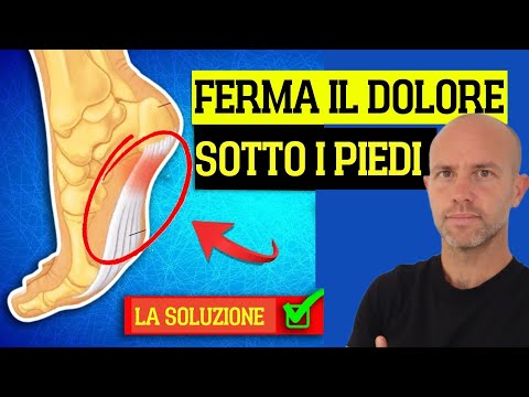 Fascite plantare: rimedi naturali efficaci