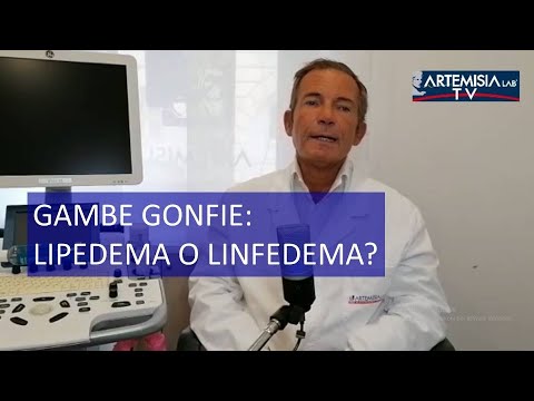 Lasix per sgonfiare le gambe: funziona davvero?