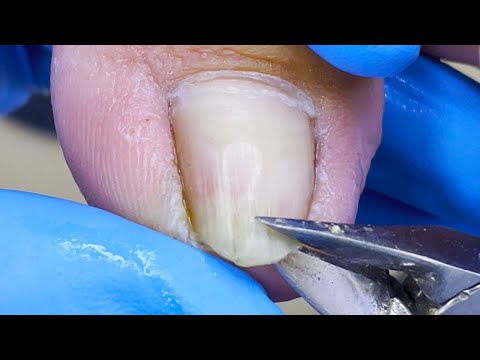 Nomi delle dita dei piedi: Guida completa