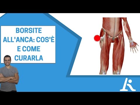 Prominenza del femore: Cos'è e come trattarla