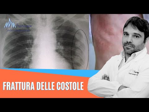 Quante costole ha il corpo umano?