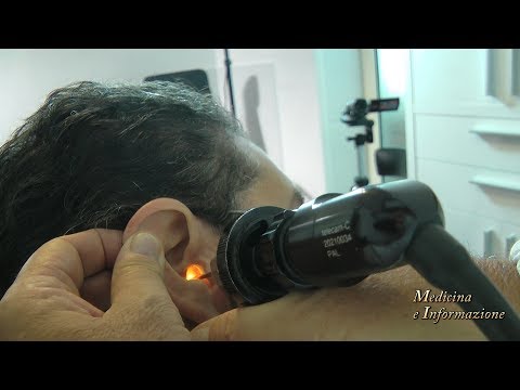 Vertigini: Cause, sintomi e quando preoccuparsi